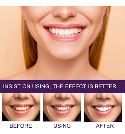 Blanqueador dental eelhoe
